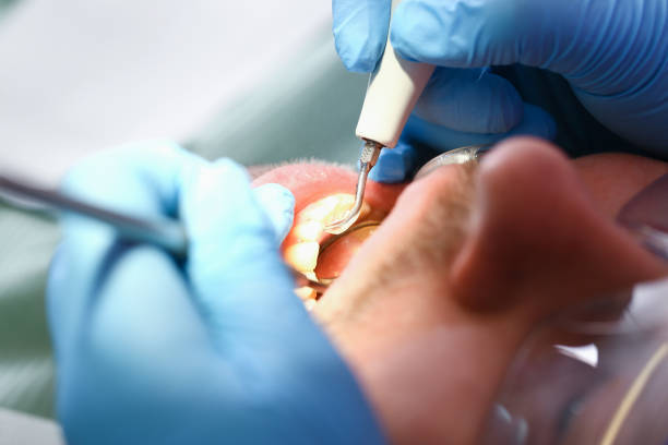 Best Pediatric Emergency Dentist in Merrick, NY